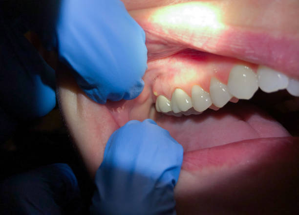 Best Weekend Emergency Dentist in Clinton, AR