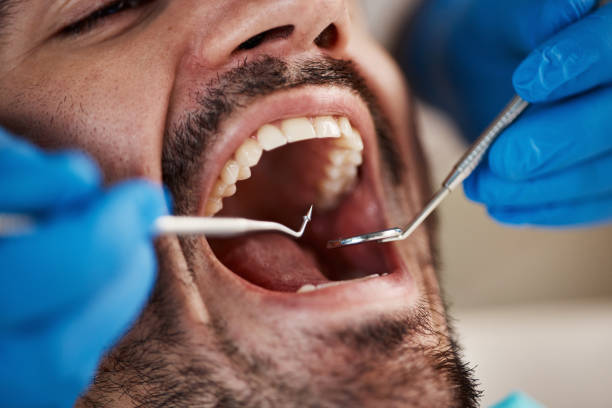 Best Broken or Cracked Tooth Emergency Dentist in Clinton, AR
