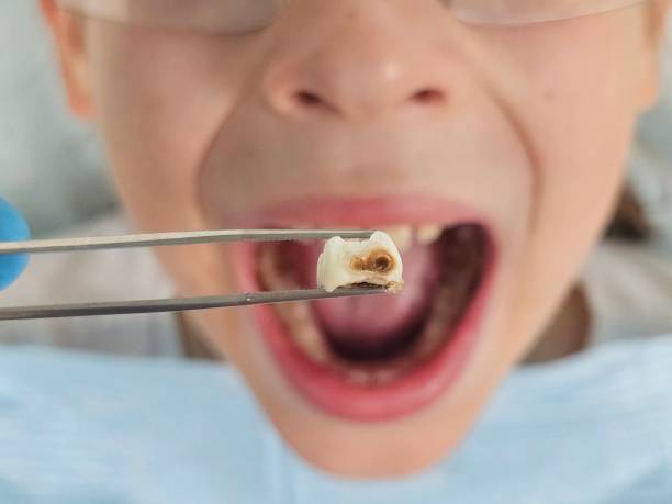Best Emergency Root Canal Treatment in Clinton, AR